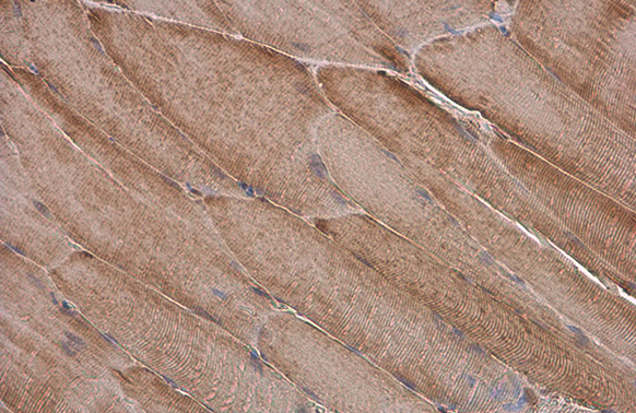 Myosin Light Chain 2 (MLC-2v) antibody detects Myosin Light Chain 2 (MLC-2v) protein at cytoplasm by immunohistochemical analysis. Sample: Paraffin-embedded mouse muscle. Myosin Light Chain 2 (MLC-2v) stained by Myosin Light Chain 2 (MLC-2v) antibody (GTX100714) diluted at 1:500. Antigen Retrieval: Citrate buffer, pH 6.0, 15 min