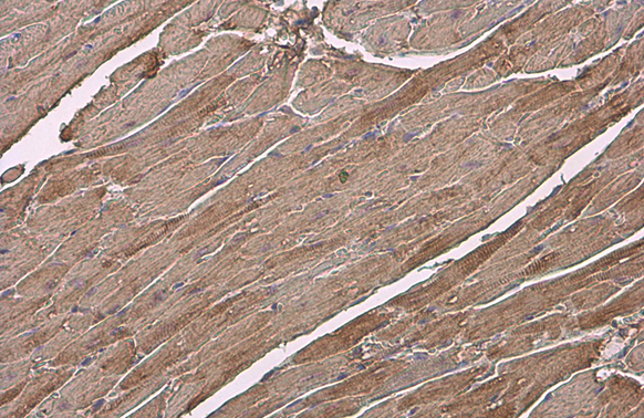 Myosin Light Chain 2 (MLC-2v) antibody detects Myosin Light Chain 2 (MLC-2v) protein at cytoplasm by immunohistochemical analysis. Sample: Paraffin-embedded mouse heart. Myosin Light Chain 2 (MLC-2v) stained by Myosin Light Chain 2 (MLC-2v) antibody (GTX100714) diluted at 1:500. Antigen Retrieval: Citrate buffer, pH 6.0, 15 min