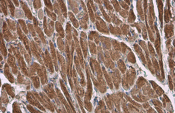 Myosin Light Chain 2 (MLC-2v) antibody detects Myosin Light Chain 2 (MLC-2v) protein at cytoplasm by immunohistochemical analysis. Sample: Paraffin-embedded rat heart. Myosin Light Chain 2 (MLC-2v) stained by Myosin Light Chain 2 (MLC-2v) antibody (GTX100714) diluted at 1:500. Antigen Retrieval: Citrate buffer, pH 6.0, 15 min
