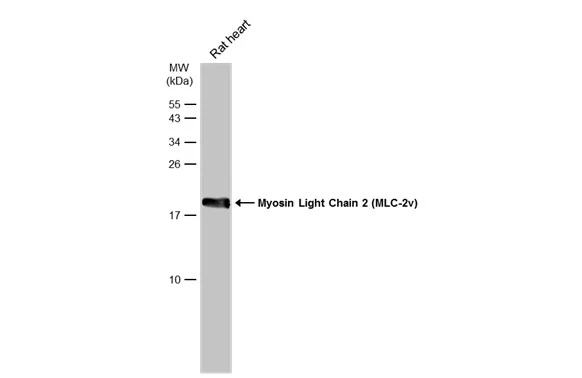 Whole cell extract (50 μg) was separated by 15% SDS-PAGE, and the membrane was blotted with Myosin Light Chain 2 (MLC-2v) antibody (GTX100714) diluted at 1:30000. The HRP-conjugated anti-rabbit IgG antibody (GTX213110-01) was used to detect the primary antibody.