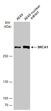 A549 whole cell and nuclear extracts (30 μg) were separated by 5% SDS-PAGE, and the membrane was blotted with BRCA1 antibody [C3], C-term (GTX100720) diluted at 1:500. The HRP-conjugated anti-rabbit IgG antibody (GTX213110-01) was used to detect the primary antibody.