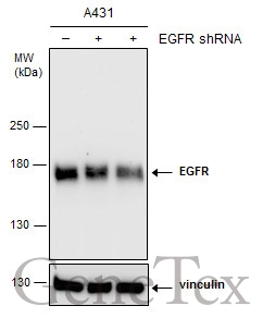 EGFR antibody [N1], N-term
