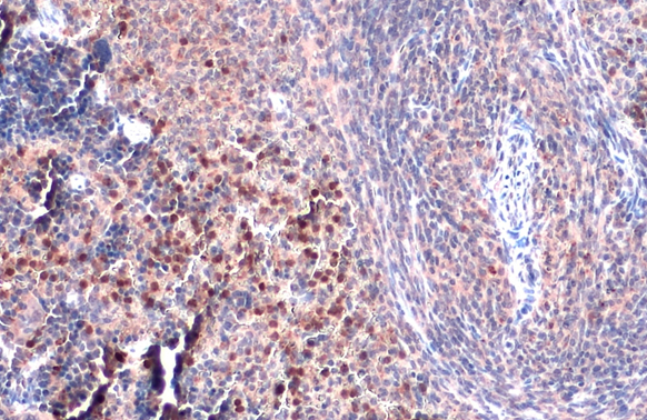 TLR9 antibody [N2], N-term detects TLR9 protein by immunohistochemical analysis. Sample: Paraffin-embedded mouse spleen. TLR9 stained by TLR9 antibody [N2], N-term (GTX100726) diluted at 1:500. Antigen Retrieval: Citrate buffer, pH 6.0, 15 min