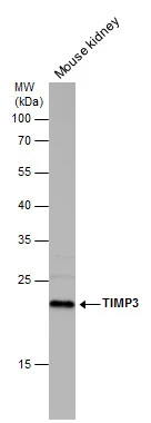 TIMP3 antibody detects TIMP3 protein by western blot analysis. Mouse tissue extracts (50 μg) was separated by 12% SDS-PAGE, and the membrane was blotted with TIMP3 antibody (GTX100742) diluted at 1:500.