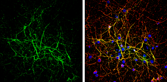 TIMP3 antibody [N1C3] detects TIMP3 protein by immunofluorescent analysis. Sample: DIV10 rat E18 primary cortical neuron cells were fixed in 4% paraformaldehyde at RT for 15 min. Green: TIMP3 stained by TIMP3 antibody [N1C3] (GTX100742) diluted at 1:500. Red: alpha Tubulin, stained by alpha Tubulin antibody [GT114] (GTX628802) diluted at 1:500. Blue: Fluoroshield with DAPI (GTX30920).