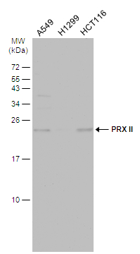 Peroxiredoxin 2 antibody detects Peroxiredoxin 2 protein at cytoplasm in rat liver by immunohistochemical analysis. Sample: Frozen section of rat liver. Peroxiredoxin 2 antibody (GTX100747) diluted at 1:200. 