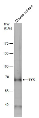 SYK antibody detects SYK protein by western blot analysis. Mouse tissue extracts (50 μg) was separated by 7.5% SDS-PAGE, and the membrane was blotted with SYK antibody (GTX100748) diluted by 1:1000. The HRP-conjugated anti-rabbit IgG antibody (GTX213110-01) was used to detect the primary antibody.