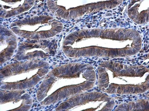 SYK antibody [N2C2], Internal detects SYK protein at cytoplasm in human endometrium by immunohistochemical analysis. Sample: Paraffin-embedded human endometrium. SYK antibody [N2C2], Internal (GTX100748) diluted at 1:500. 
 Antigen Retrieval: Citrate buffer, pH 6.0, 15 min