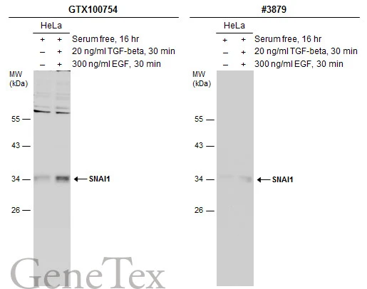 Anti-SNAI1 antibody (GTX100754) | GeneTex