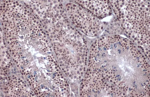 Anti-SNAI1 antibody (GTX100754) | GeneTex