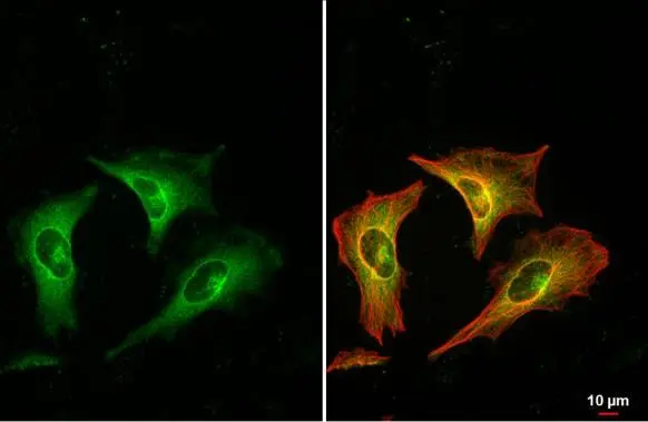 RRM1 antibody detects RRM1 protein at cytoplasm by immunofluorescent analysis. Sample: HeLa cells were fixed in ice-cold MeOH for 5 min. Green: RRM1 stained by RRM1 antibody (GTX100758) diluted at 1:500. Red: alpha Tubulin, a cytoskeleton marker, stained by alpha Tubulin antibody [GT114] (GTX628802) diluted at 1:1000.
