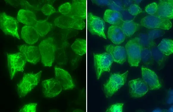 Rac1 antibody detects Rac1 protein at cytoskeleton? by immunofluorescent analysis. Sample: A431 cells were fixed in 4% paraformaldehyde at RT for 15 min. Green: Rac1 stained by Rac1 antibody (GTX100761) diluted at 1:500. Blue: Fluoroshield with DAPI (GTX30920).