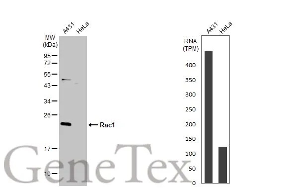 Various whole cell extracts (30 μg) were separated by 12% SDS-PAGE, and the membrane was blotted with Rac1 antibody (GTX100761) diluted at 1:1000. The HRP-conjugated anti-rabbit IgG antibody (GTX213110-01) was used to detect the primary antibody. Corresponding RNA expression data for the same cell lines are based on Human Protein Atlas program.