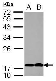 PTHLH antibody [N1C3]