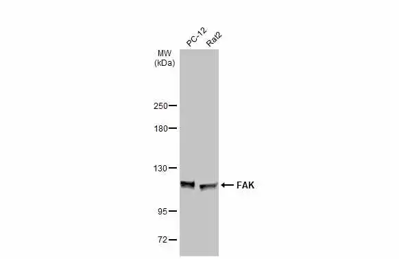 Various whole cell extracts (30 μg) were separated by 5% SDS-PAGE, and the membrane was blotted with FAK antibody (GTX100764) diluted at 1:2000. The HRP-conjugated anti-rabbit IgG antibody (GTX213110-01) was used to detect the primary antibody.