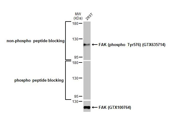 Whole cell extract (30 μg) was separated by 5% SDS-PAGE, and the membrane was blotted with FAK antibody (GTX100764) diluted at 1:1000. The HRP-conjugated anti-rabbit IgG antibody (GTX213110-01) was used to detect the primary antibody, and the signal was developed with Trident ECL plus-Enhanced.