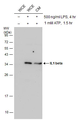 Untreated (–) and treated (+) THP-1 whole cell extracts (30 μg) were separated by 12% SDS-PAGE, and the membrane was blotted with IL1 beta antibody [N1C3] (GTX100793) diluted at 1:500. (WCE: whole cell extract; CM: conditioned medium)
