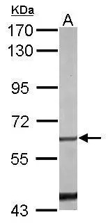Sample (50 μg of whole cell lysate) A: mouse liver 7.5% SDS PAGE GTX100797 diluted at 1:1000 The HRP-conjugated anti-rabbit IgG antibody (GTX213110-01) was used to detect the primary antibody.