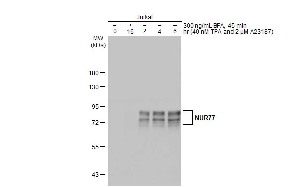 Untreated and treated Jurkat whole cell extracts (30 μg) were separated by 7.5% SDS-PAGE, and the membrane was blotted with NUR77 antibody (GTX100797) diluted at 1:500. The HRP-conjugated anti-rabbit IgG antibody (GTX213110-01) was used to detect the primary antibody.