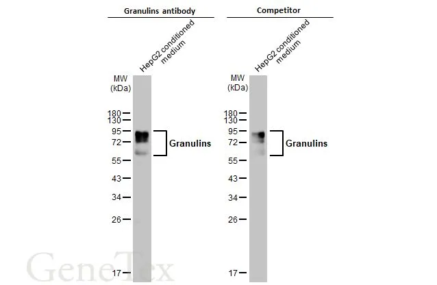 HepG2 conditioned medium (30 μg) was separated by 12% SDS-PAGE, and the membranes were blotted with Granulins antibody (GTX100803) diluted at 1:1000 and competitor's antibody (Competitor) diluted at 1:1000. The HRP-conjugated anti-rabbit IgG antibody (GTX213110-01) was used to detect the primary antibody. *The competitor is not affiliated with GeneTex and does not endorse this product.