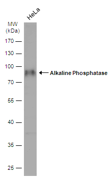 Immunohistochemical analysis of paraffin-embedded OVCAR3 xenograft ,using alkaline phosphatase (liver/bone/kidney)(GTX100817) antibody at 1:100 dilution. Antigen Retrieval: Trilogy? (EDTA based,pH 8.0) buffer,15min