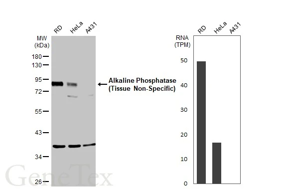 Various whole cell extracts (30 μg) were separated by 10% SDS-PAGE, and the membrane was blotted with Alkaline Phosphatase (Tissue Non-Specific) antibody (GTX100817) diluted at 1:1000. The HRP-conjugated anti-rabbit IgG antibody (GTX213110-01) was used to detect the primary antibody. Corresponding RNA expression data for the same cell lines are based on Human Protein Atlas program.