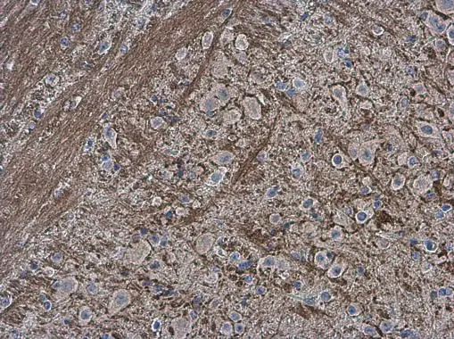 Collagen II antibody [N1], N-term detects Collagen II protein at cytoplasm in mouse brain by immunohistochemical analysis. Sample: Paraffin-embedded mouse brain. Collagen II antibody [N1], N-term (GTX100829) diluted at 1:500. 
 Antigen Retrieval: Citrate buffer, pH 6.0, 15 min
