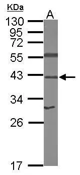 Sample (50 μg of whole cell lysate) A: mouse brain 12% SDS PAGE GTX100831 diluted at 1:1000 The HRP-conjugated anti-rabbit IgG antibody (GTX213110-01) was used to detect the primary antibody.