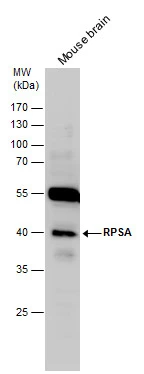 RPSA antibody detects RPSA protein by Western blot analysis. Mouse tissue extracts (50 μg) was separated by 10 % SDS-PAGE, and the membrane was blotted with RPSA antibody (GTX100831) diluted by 1:1000.