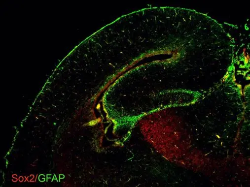 GFAP antibodies detects GFAP proteins on embryonic mouse brain by immunohistochemical analysis. Sample: Frozen section of embryonic mouse brain (mE18.5). Green: GFAP antibody (GTX100850) diluted at 1:500. Red: Sox2 antibody [GT1876] (GTX627404) diluted at 1:500.