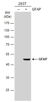 Non-transfected (–) and transfected (+) 293T whole cell extracts (30 μg) were separated by 10% SDS-PAGE, and the membrane was blotted with GFAP antibody (GTX100850) diluted at 1:2500. The HRP-conjugated anti-rabbit IgG antibody (GTX213110-01) was used to detect the primary antibody. Non-transfected (–) and transfected (+) 293T whole cell extracts (30 μg) were separated by 10% SDS-PAGE, and the membrane was blotted with GFAP antibody (GTX100850) diluted at 1:2500. The HRP-conjugated anti-rabbit IgG antibody (GTX213110-01) was used to detect the primary antibody.