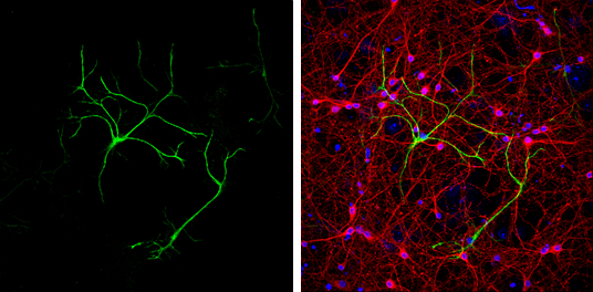 GFAP antibody detects GFAP protein at glia cells by immunofluorescent analysis. Sample: DIV9 rat E18 primary cortical neurons were fixed in 4% paraformaldehyde at RT for 15 min. Green: GFAP protein stained by GFAP antibody (GTX100850) diluted at 1:500. Red: beta Tubulin 3/ Tuj1, a neuron cell marker, stained by beta Tubulin 3/ Tuj1 antibody [GT11710] (GTX631836) diluted at 1:500. Blue: Fluoroshield with DAPI (GTX30920).