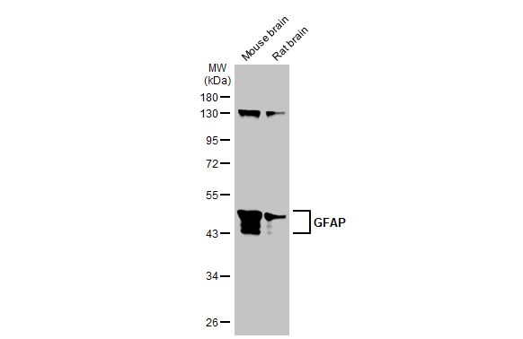 anti-gfap antibody used in western blot (wb). gtx100850