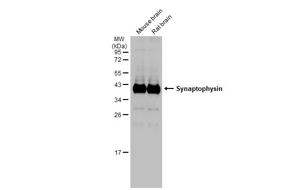 Antibodies Antoine D'Agata 抗体 アントワーヌダガタ A single injection of anti-HIV-1 antibodies protects against