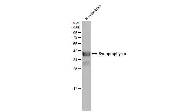 Human Cytogenetics 第3版 Anti-Synaptophysin antibody (GTX100865) | GeneTex