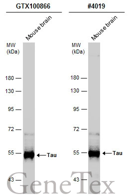 Mouse tissue extract (50 μg) was separated by 7.5% SDS-PAGE, and the membranes were blotted with Tau antibody (GTX100866) diluted at 1:2000 and competitor's antibody (CST#4019) diluted at 1:1000. The HRP-conjugated anti-rabbit IgG antibody (GTX213110-01) was used to detect the primary antibody. Mouse tissue extract (50 μg) was separated by 7.5% SDS-PAGE, and the membranes were blotted with Tau antibody (GTX100866) diluted at 1:2000 and competitor's antibody (CST#4019) diluted at 1:1000. The HRP-conjugated anti-rabbit IgG antibody (GTX213110-01) was used to detect the primary antibody.