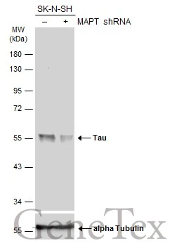 Non-transfected (–) and transfected (+) SK-N-SH whole cell extracts (30 μg) were separated by 10% SDS-PAGE, and the membrane was blotted with Tau antibody (GTX100866) diluted at 1:500. The HRP-conjugated anti-rabbit IgG antibody (GTX213110-01) was used to detect the primary antibody. Non-transfected (–) and transfected (+) SK-N-SH whole cell extracts (30 μg) were separated by 10% SDS-PAGE, and the membrane was blotted with Tau antibody (GTX100866) diluted at 1:500. The HRP-conjugated anti-rabbit IgG antibody (GTX213110-01) was used to detect the primary antibody.