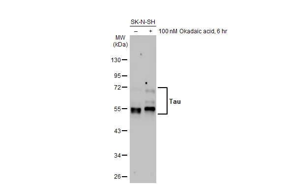 Untreated (–) and treated (+) SK-N-SH whole cell extract (30 μg) were separated by 10% SDS-PAGE, and the membrane was blotted with Tau antibody (GTX100866) diluted at 1:2000. The HRP-conjugated anti-rabbit IgG antibody (GTX213110-01) was used to detect the primary antibody, and the signal was developed with Trident ECL plus-Enhanced.