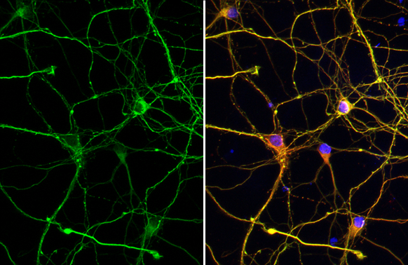 Tau antibody detects Tau protein at cytoskeleton by immunofluorescent analysis. Sample: DIV9 rat E18 primary cortical neuron cells were fixed in 4% paraformaldehyde at RT for 15 min. Green: Tau stained by Tau antibody (GTX100866) diluted at 1:250. Red: Tau, an axon marker, stained by Tau antibody [GT287] (GTX634809) diluted at 1:500. Blue: Fluoroshield with DAPI (GTX30920).