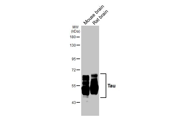 Various tissue extracts (30 μg) were separated by 7.5% SDS-PAGE, and the membrane was blotted with Tau antibody (GTX100866) diluted at 1:10000. The HRP-conjugated anti-rabbit IgG antibody (GTX213110-01) was used to detect the primary antibody. Various tissue extracts (30 μg) were separated by 7.5% SDS-PAGE, and the membrane was blotted with Tau antibody (GTX100866) diluted at 1:10000. The HRP-conjugated anti-rabbit IgG antibody (GTX213110-01) was used to detect the primary antibody.