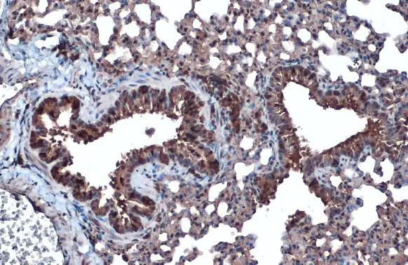 BMP4 antibody detects BMP4 protein at cell membrane and cytoplasm by immunohistochemical analysis. Sample: Paraffin-embedded mouse lung. BMP4 stained by BMP4 antibody (GTX100875) diluted at 1:1000. Antigen Retrieval: Citrate buffer, pH 6.0, 15 min BMP4 antibody detects BMP4 protein at cell membrane and cytoplasm by immunohistochemical analysis. Sample: Paraffin-embedded mouse lung. BMP4 stained by BMP4 antibody (GTX100875) diluted at 1:1000. Antigen Retrieval: Citrate buffer, pH 6.0, 15 min