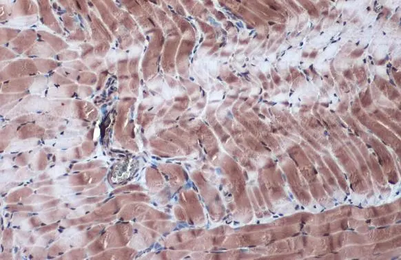 BMP4 antibody detects BMP4 protein at cell membrane and cytoplasm by immunohistochemical analysis. Sample: Paraffin-embedded rat smooth muscle. BMP4 stained by BMP4 antibody (GTX100875) diluted at 1:1000. Antigen Retrieval: Citrate buffer, pH 6.0, 15 min BMP4 antibody detects BMP4 protein at cell membrane and cytoplasm by immunohistochemical analysis. Sample: Paraffin-embedded rat smooth muscle. BMP4 stained by BMP4 antibody (GTX100875) diluted at 1:1000. Antigen Retrieval: Citrate buffer, pH 6.0, 15 min