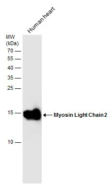 Human tissue extract (30 μg) was separated by 15% SDS-PAGE, and the membrane was blotted with Myosin Light Chain 2 antibody (GTX100888) diluted at 1:1000.
