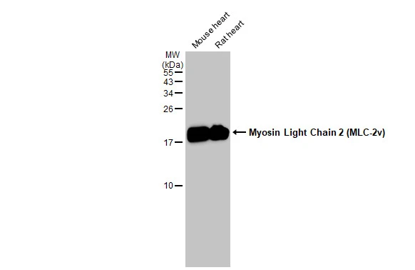 Various tissue extracts (50 μg) were separated by 15% SDS-PAGE, and the membrane was blotted with Myosin Light Chain 2 (MLC-2v) antibody (GTX100888) diluted at 1:10000. The HRP-conjugated anti-rabbit IgG antibody (GTX213110-01) was used to detect the primary antibody.