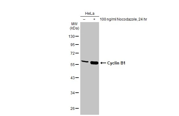 Anti-Cyclin B1 antibody (GTX100911) | GeneTex