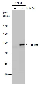 B-Raf antibody [N2C1], Internal detects B-Raf protein by western blot analysis. Non-transfected (-) and B-Raf-transfected (+) 293T whole cell extracts (30 μg) were separated by 7.5% SDS-PAGE, and the membrane was blotted with B-Raf antibody [N2C1], Internal (GTX100913) diluted at 1:5000.