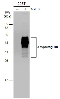 Non-transfected (–) and transfected (+) 293T whole cell extracts (30 μg) were separated by 12% SDS-PAGE, and the membrane was blotted with Amphiregulin antibody (GTX100986) diluted at 1:3000. The HRP-conjugated anti-rabbit IgG antibody (GTX213110-01) was used to detect the primary antibody.