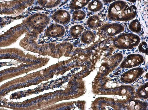 Angiopoietin 4 antibody detects Angiopoietin 4 protein at cytoplasm on mouse duodenum by immunohistochemical analysis. Sample: Paraffin-embedded mouse duodenum. Angiopoietin 4 antibody (GTX100993) diluted at 1:500.
Antigen Retrieval: Citrate buffer, pH 6.0, 15 min Angiopoietin 4 antibody detects Angiopoietin 4 protein at cytoplasm on mouse duodenum by immunohistochemical analysis. Sample: Paraffin-embedded mouse duodenum. Angiopoietin 4 antibody (GTX100993) diluted at 1:500.
Antigen Retrieval: Citrate buffer, pH 6.0, 15 min