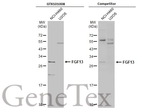 Various whole cell extracts (30 μg) were separated by 12% SDS-PAGE, and the membranes were blotted with FGF13 antibody (GTX101008) diluted at 1:500 and competitor's antibody (Competitor) diluted at 1:500. The HRP-conjugated anti-rabbit IgG antibody (GTX213110-01) was used to detect the primary antibody. *The competitor is not affiliated with GeneTex and does not endorse this product.