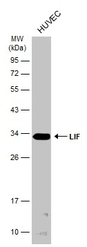Whole cell extract (30 μg) was separated by 12% SDS-PAGE, and the membrane was blotted with LIF antibody (GTX101021) diluted at 1:1000. The HRP-conjugated anti-rabbit IgG antibody (GTX213110-01) was used to detect the primary antibody.